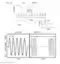 Fig. 05 - Systems and methods for vagal nerve stimulation