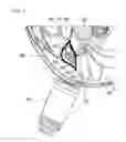 Fig. 13 - Systems and methods for vagal nerve stimulation