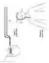 Fig. 02 - Skull-mounted deep brain stimulator