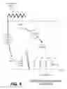 Fig. 04 - External defibrillation with automatic post-shock anti-tachycardia (APSAT) pacing based on pre-shock ECG