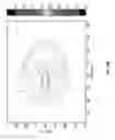 Fig. 49 - System and methods of photon-based radiotherapy and radiosurgery delivery