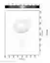 Fig. 59 - System and methods of photon-based radiotherapy and radiosurgery delivery