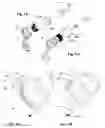 Fig. 06 - Evacuation device