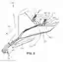 Fig. 06 - Aircraft body and method of making the same