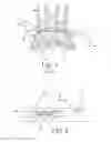 Fig. 02 - Aircraft engine assembly comprising rear engine attachments in the form of shackles