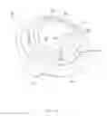 Fig. 11 - Aerosol valve