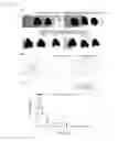 Fig. 13 - BENZIMIDAZOLE COMPOUNDS AND THEIR APPLICATION IN CARDIOVASCULAR DISEASES