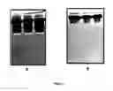 Fig. 02 - Process for the purification of TNFR:Fc fusion protein