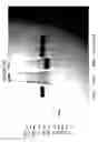 Fig. 09 - Functional antibody fragment complementation for a two-components system for redirected killing of unwanted cells