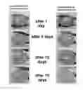 Fig. 01 - MICROBIAL OIL AND FAT CLEANING AGENT COMPOSITION BLOCK FOR DRAINPIPES AND METHOD OF PRODUCING THE SAME