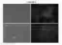 Fig. 08 - Hepatic stellate cell precursors and methods of isolating same