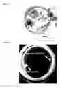 Fig. 04 - HUMAN PLURIPOTENT STEM CELLS PRODUCED BY SOMATIC CELL NUCLEAR TRANSFER