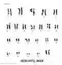 Fig. 19 - HUMAN PLURIPOTENT STEM CELLS PRODUCED BY SOMATIC CELL NUCLEAR TRANSFER