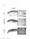 Fig. 12 - Composition including Stem Cell-Derived Exosome for Inducing Adipogenic Differentiation and Adipose Tissue Regeneration