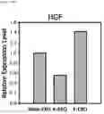 Fig. 35 - Composition including Stem Cell-Derived Exosome for Inducing Adipogenic Differentiation and Adipose Tissue Regeneration