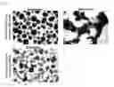 Fig. 20 - Method for inducing cardiac differentiation of pluripotent stem cell with low-molecular compounds