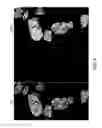 Fig. 09 - METHOD FOR CULTURE OF HUMAN BLADDER CELL LINES AND ORGANOIDS AND USES THEREOF