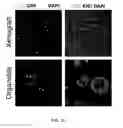 Fig. 16 - METHOD FOR CULTURE OF HUMAN BLADDER CELL LINES AND ORGANOIDS AND USES THEREOF