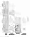Fig. 22 - METHOD FOR CULTURE OF HUMAN BLADDER CELL LINES AND ORGANOIDS AND USES THEREOF
