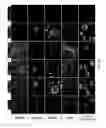 Fig. 23 - METHOD FOR CULTURE OF HUMAN BLADDER CELL LINES AND ORGANOIDS AND USES THEREOF