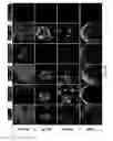 Fig. 24 - METHOD FOR CULTURE OF HUMAN BLADDER CELL LINES AND ORGANOIDS AND USES THEREOF