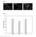 Fig. 02 - Method of differentiating adult stem cells into nerve cells by using high-intensity electromagnetic field