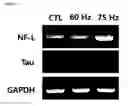 Fig. 03 - Method of differentiating adult stem cells into nerve cells by using high-intensity electromagnetic field