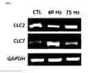 Fig. 04 - Method of differentiating adult stem cells into nerve cells by using high-intensity electromagnetic field