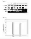 Fig. 06 - Method of differentiating adult stem cells into nerve cells by using high-intensity electromagnetic field