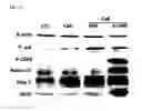 Fig. 08 - Method of differentiating adult stem cells into nerve cells by using high-intensity electromagnetic field