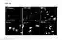 Fig. 16 - Method of differentiating adult stem cells into nerve cells by using high-intensity electromagnetic field