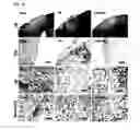 Fig. 24 - Method of differentiating adult stem cells into nerve cells by using high-intensity electromagnetic field
