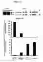 Fig. 02 - Modulation of BCL11A for treatment of hemoglobinopathies