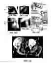 Fig. 28 - ENGINEERING OF HUMANIZED CAR T-CELL AND PLATELETS BY GENETIC COMPLEMENTATION
