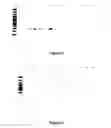 Fig. 03 - Aberrant mitochondrial DNA, associated fusion transcripts and hybridization probes therefor