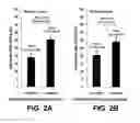 Fig. 04 - METHODS AND COMPOSITIONS FOR DETERMINING INDICATION FOR PROSTATE BIOPSY