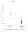 Fig. 03 - Methods for detecting gene dysregulation by intragenic differential expression