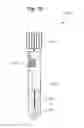 Fig. 17 - Systems and methods for detection of cells using engineered transduction particles