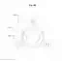 Fig. 87 - Systems and methods for detection of cells using engineered transduction particles