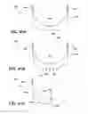 Fig. 43 - Laundry treating appliance