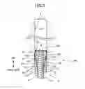 Fig. 04 - Anchor bolt