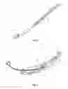 Fig. 03 - Chain-tensioning rod