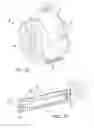 Fig. 02 - Airflow vent for a transmission