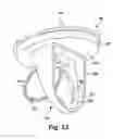 Fig. 20 - Backwater valve assembly and method