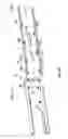Fig. 49 - Bracket assembly for media patching system