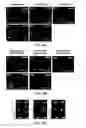 Fig. 08 - LENS-FREE TOMOGRAPHIC IMAGING DEVICES AND METHODS