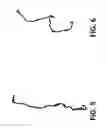 Fig. 05 - Irregular feature mapping