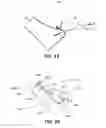 Fig. 11 - Irregular feature mapping