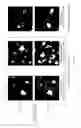 Fig. 11 - Erythrocyte aggregation and leukocyte isolation