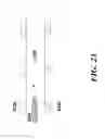 Fig. 49 - Devices for detecting or filtering tumor cells